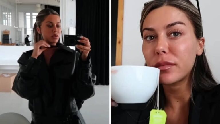 Ingrossos ånger efter nya skönhetsingreppen