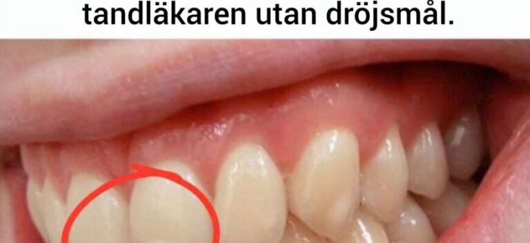 För alla som inte är medvetna