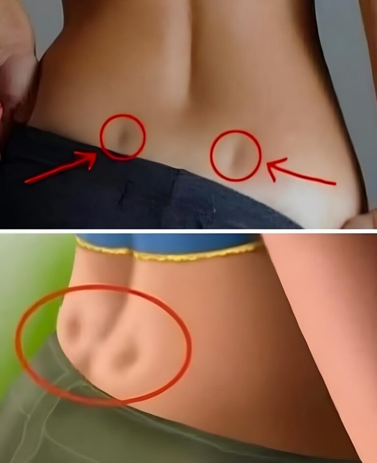 Har du två små gropar på ryggen betyder det att du inte…»