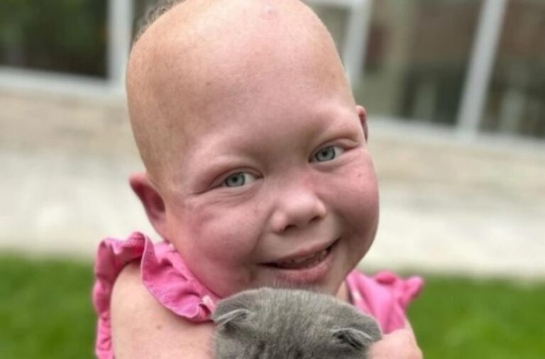 ”Jag är tio år gammal, men min kropp är som en ett-åriga barn: konto tjej som övervann flera operationer för att leva!”