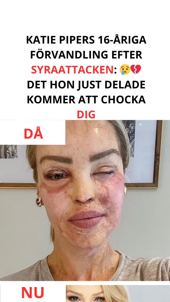 Katie Piper delar med sig av en upplyftande uppdatering 16 år efter att ha övervunnit syraattacken