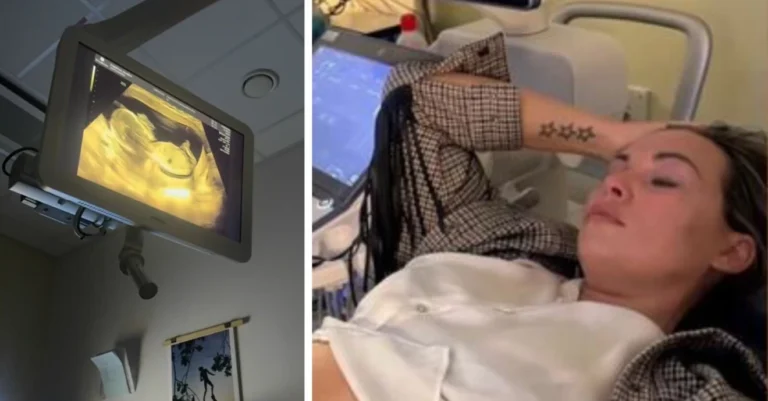 Calle Schulman och gravida flickvännens oro – barnet har fläckar på hjärtat