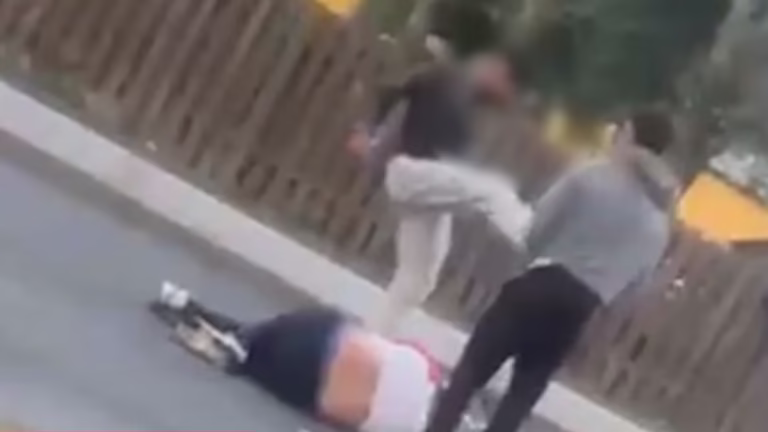 Alex försvarade äldre man – fick lårbenet avsparkat av två killar