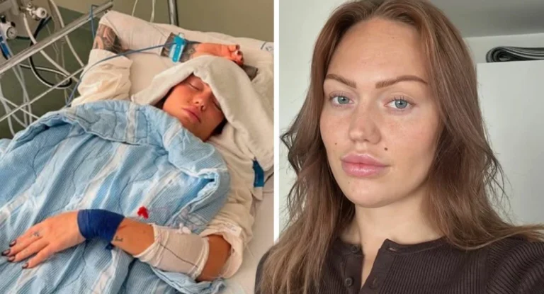 Svenska influencern i svår olycka – kampen för sitt liv: ”Fått en hjärnblödning”