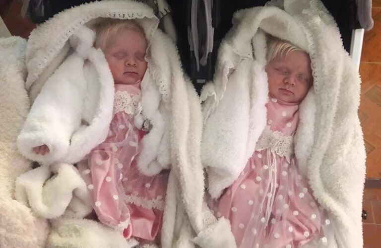 Makar föder sällsynta albinotvillingar: år senare förvånar deras barn världen