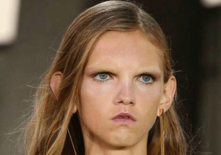 ”Arg” tjejmodell med Fomo: hur mycket hon har förändrats år senare och hur hon ser ut idag