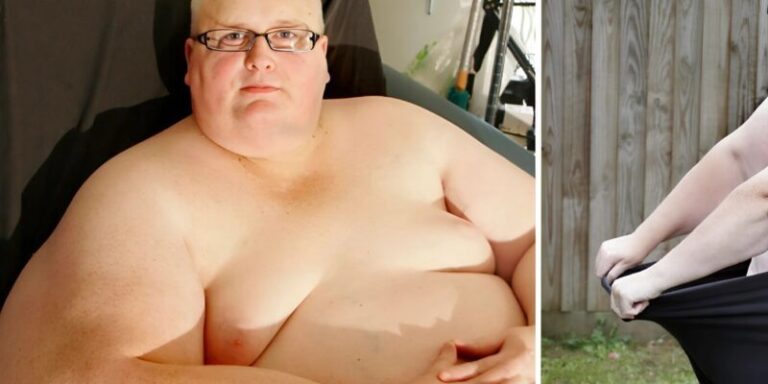 För 6 år sedan vägde den här mannen 450 kg men gick ner i vikt för kvinnan han älskar: Så här ser han ut nu