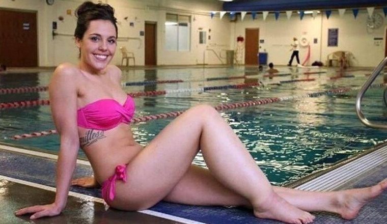 Lymphedema är svullnad som uppstår vanligtvis i en av armarna eller benen