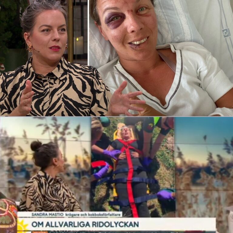 ”Mästerkock”-vinnaren drabbades av hjärnblödning efter den traumatiska olyckan – ”Många av mina minnen har försvunnit”