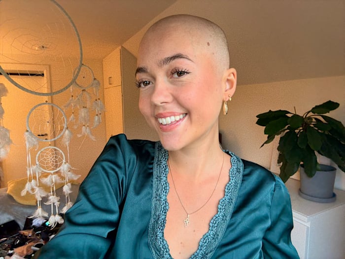 Ovanlig cancer drabbar Moa, 22: “En dag i taget” – samtidigt som hon väcker medvetenhet om sjukdomen