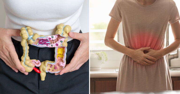 Symptom på tjock-och ändtarmscancer du inte bör ignorera